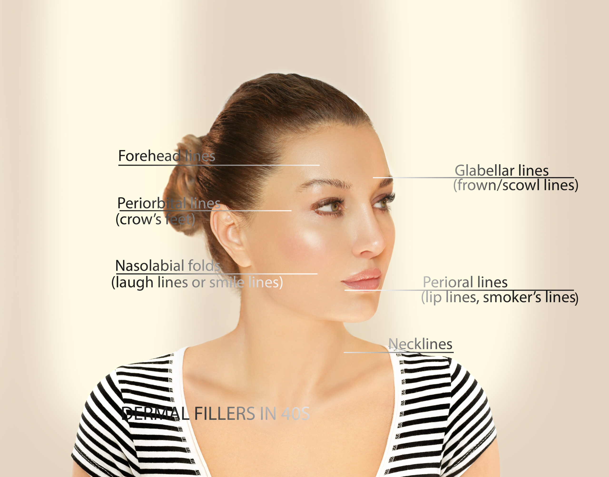 Dermal,Filler,Treatments,.hyaluronic,Acid,Injections,For,Specific,Areas.correct,Wrinkles